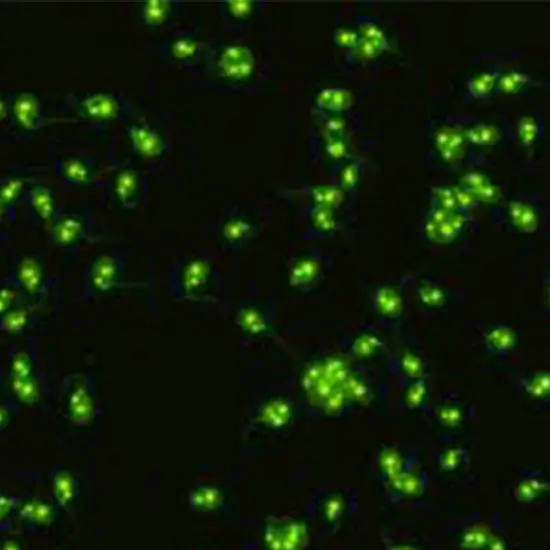 parietal cell antibody, ifa test